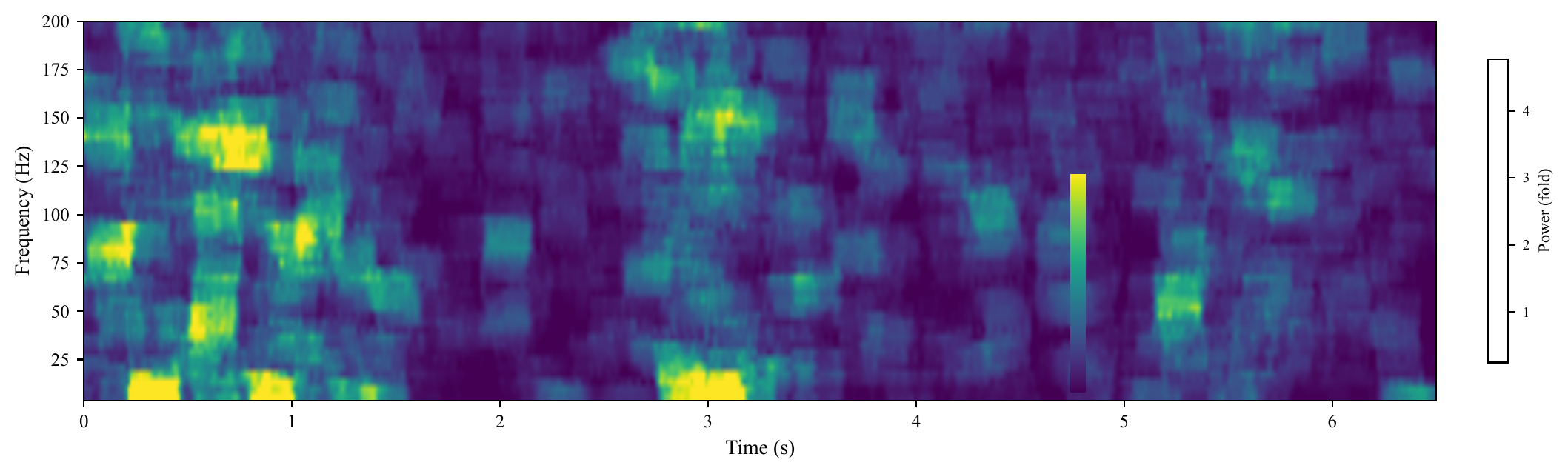 Neural signal spectrogram showing power across time and frequency